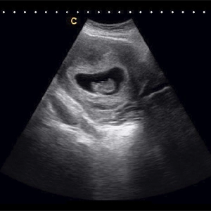 2D Ultrasound 1