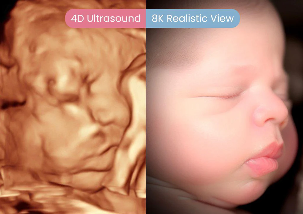 Ultrasound Example